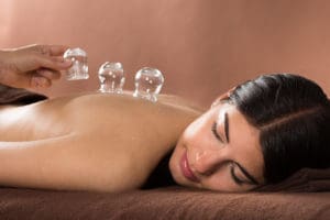 The Olympics, Cupping, and Acupuncture
