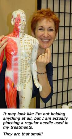 Jill holding an acupuncture needle. Jill holding an acupuncture needle.