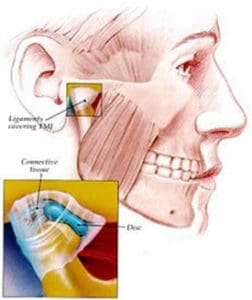TemporomandibularJoint